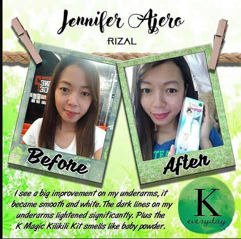 Jennifer Arceo, Antipolo " I see a big improvement on my underarms, it became smooth and white. The dark lines on my underarms lightened significantly. Plus the K Magic Kili kili kit smells like baby powder."  Thank you Ms. Korina Sanchez! 