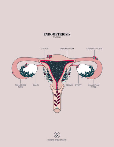 Endometriosis and uterus anatomy illustration by Duvet Days
