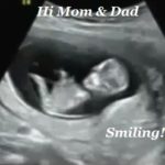 2D Prenatal Baby Gender Reveal Ultrasound Scan