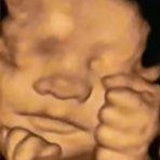 3D 4D Prenatal Ultrasound Baby Gender Reveal Scan