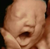 3D 4D Prenatal Ultrasound Baby Gender Reveal Scan