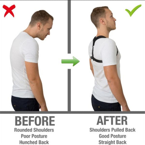 How would posture corrector fix bad posture before and after