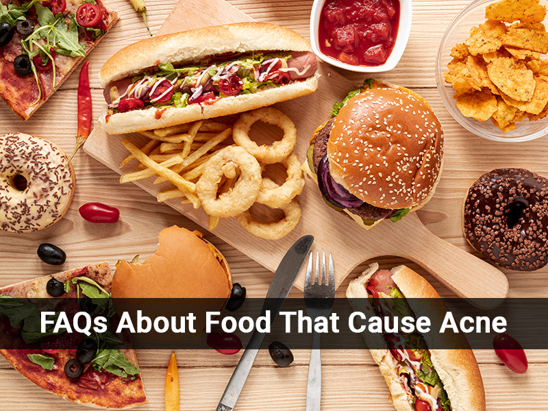 FAQs About Foods Causing Acne
