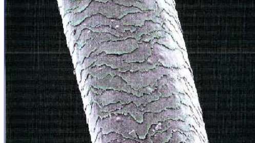 abrasion image