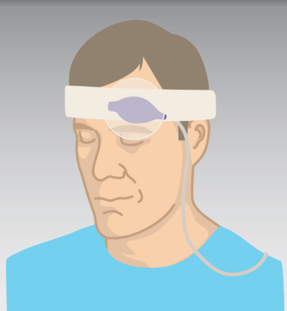 Pulse oximetry reflectance probe attached low across a patient's forehead