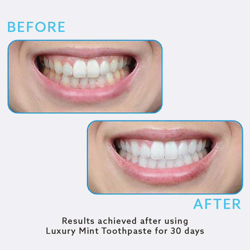 Wholesale: Luxury Mint Toothpaste