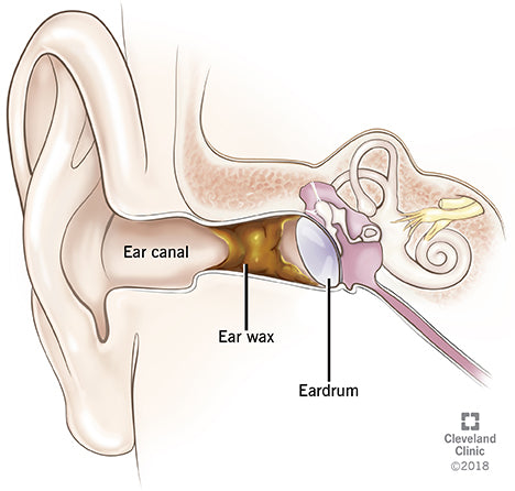 Ear Wax and Ear Canal 