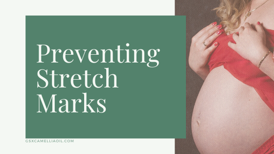 Preventing Stretch Marks image with pregnant woman