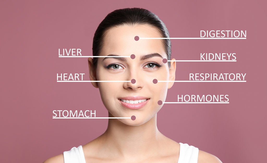 Acne Placement Chart