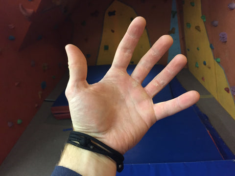 Callused hand post rock climbing