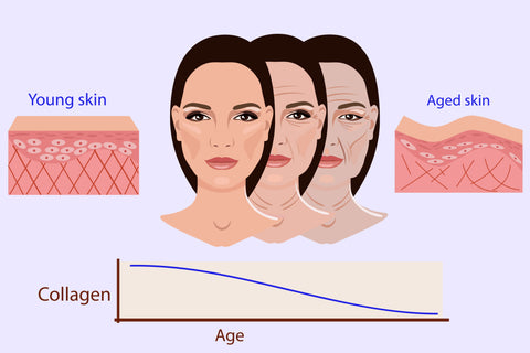 Signs of lack of collagen