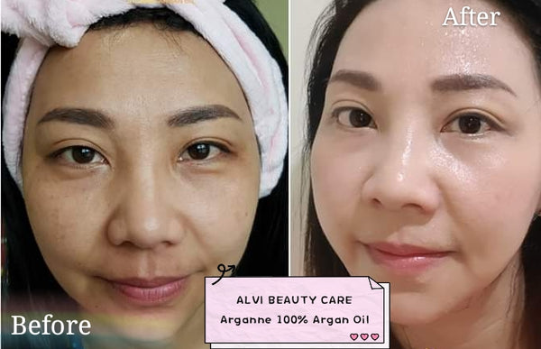 Best Argan Oil for Face, Argan Oil Benefits, Where to Buy Argan Oil, Before and After Photos