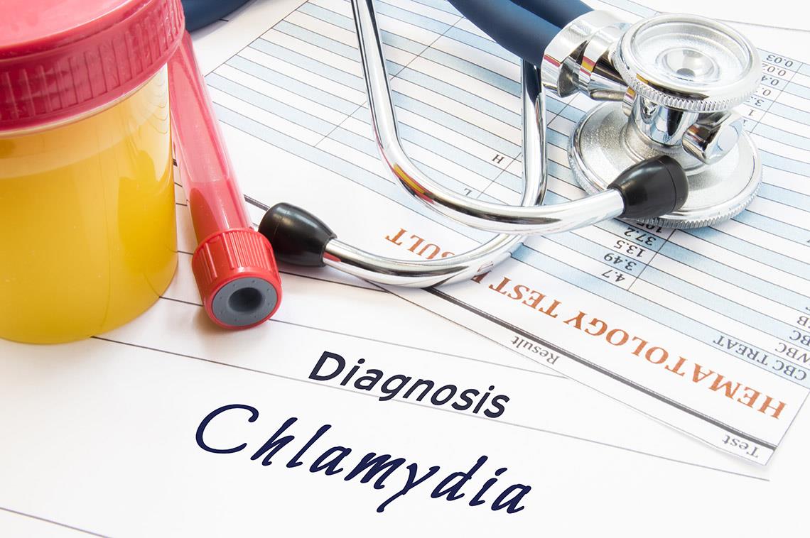 Treating chlamydia is no big deal for now