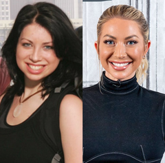 Stassi Schroeder' amazing transformation following  chin implant | Pure You