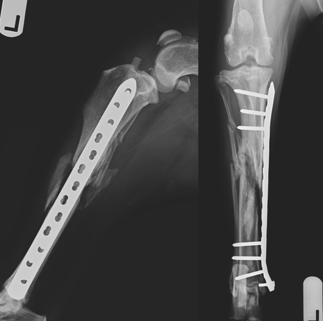 Case 4 IMPeek plate rod 10 week post op radiographs