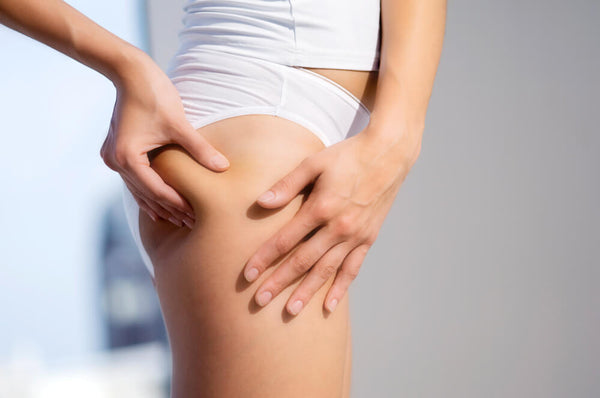 home remedies to remove cellulite