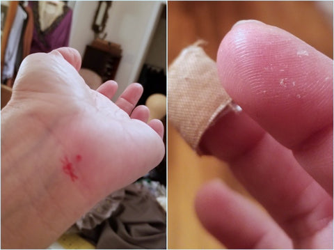 a few of my hat-cobbling injuries