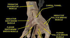 Carpal tunnel dissection