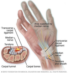 carpal tunnel diagram