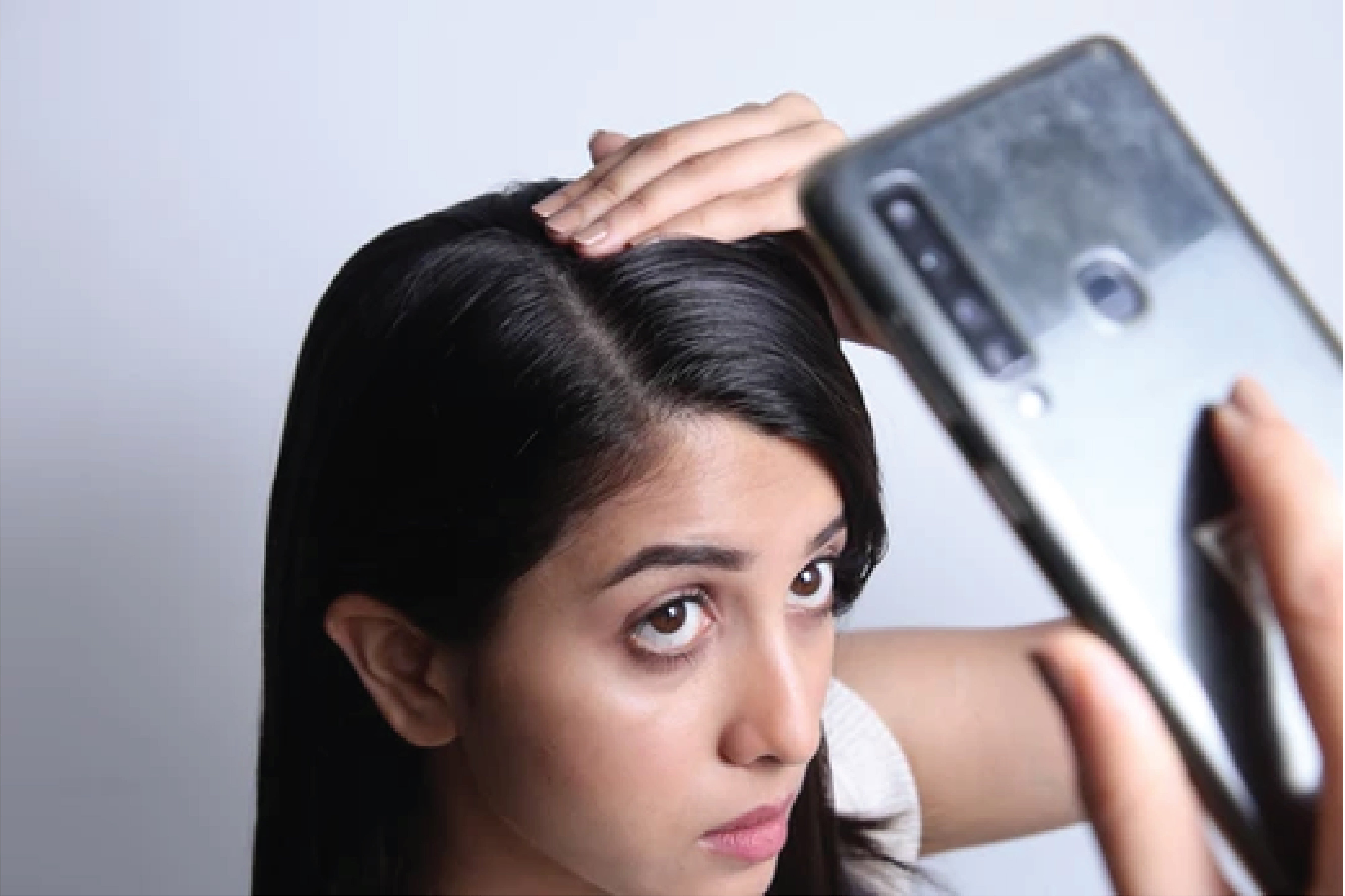 Hair Treatment Online - Online Diagnosis & Treatment for Hair Loss – Traya