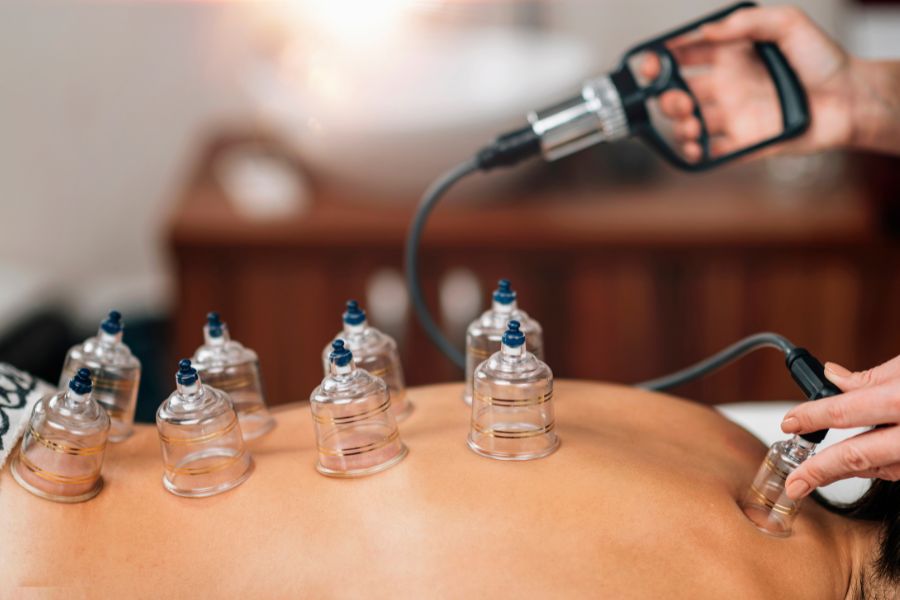 Does Cupping Therapy Help In Hair Growth? – Traya