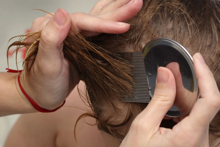 How To Get Rid Of Head Lice: Causes And Treatment – Traya