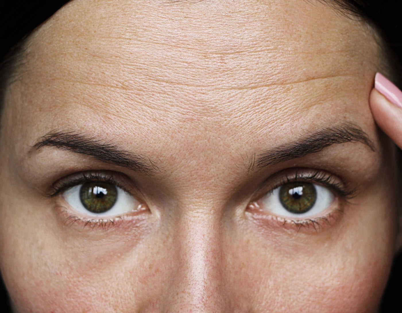 The Best Anti-Aging Ingredients for Diminishing Forehead Wrinkles