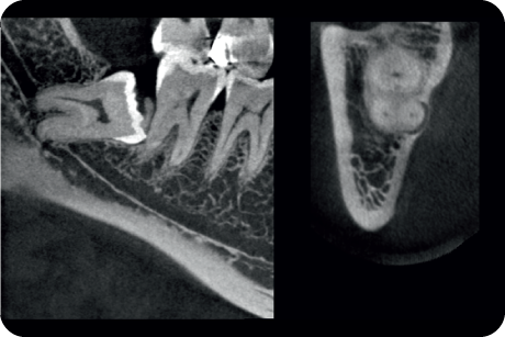 Identify relationships between impacted teeth and vital anatomical structures