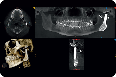 Make preoperative and post-operative assessments