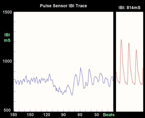 Pulse Sensor IBI Trace