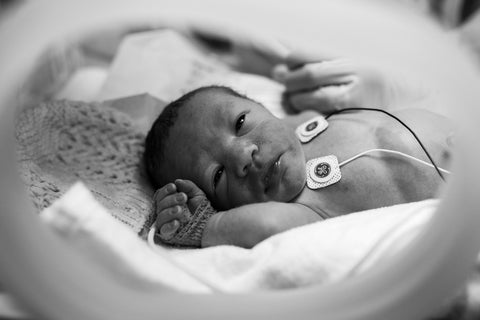 Birth Photography NICU Adelaide