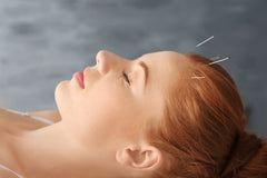 buy acupuncture needles in canada at lierre.ca 