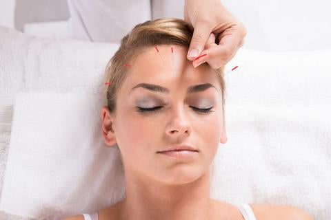 Acupuncture Needles for pain in Canada - Lierre.ca