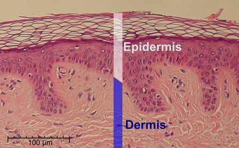 Layers of the Epidermis (By Normal_Epidermis_and_Dermis_with_Intradermal_Nevus)