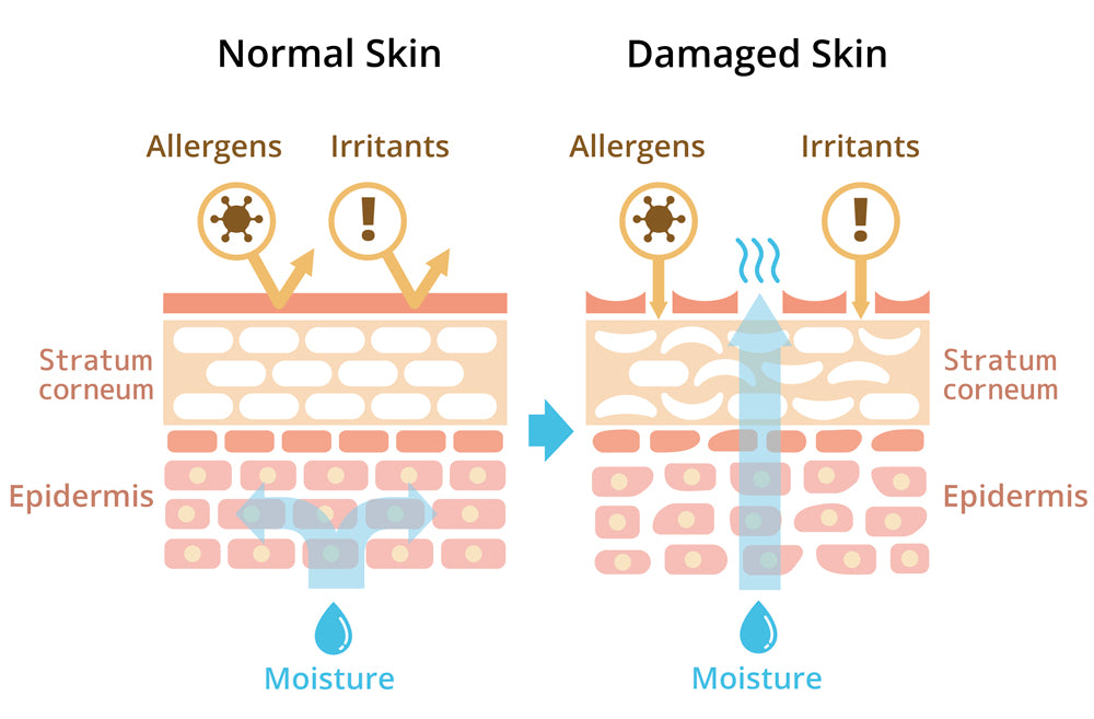 Skin Barrier Function