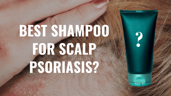 Best Scalp Psoriasis – Hanna