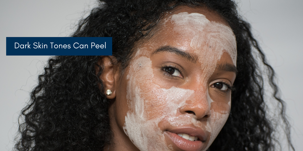 Skin Peels For Black Women