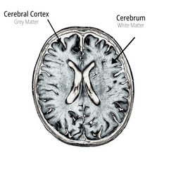 Cerebral cortex grey matter and cerebrum white matter human brain showing regions that improve with. yoga practice