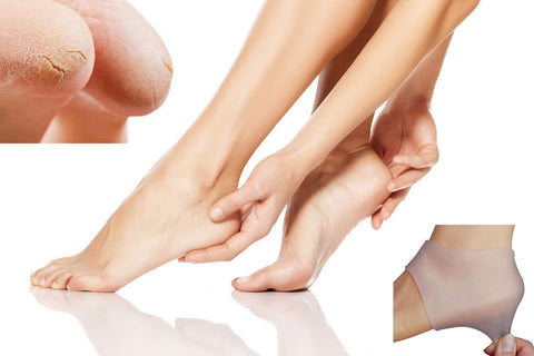 Heel Care Silicone Gel Sleeves Cracked heels