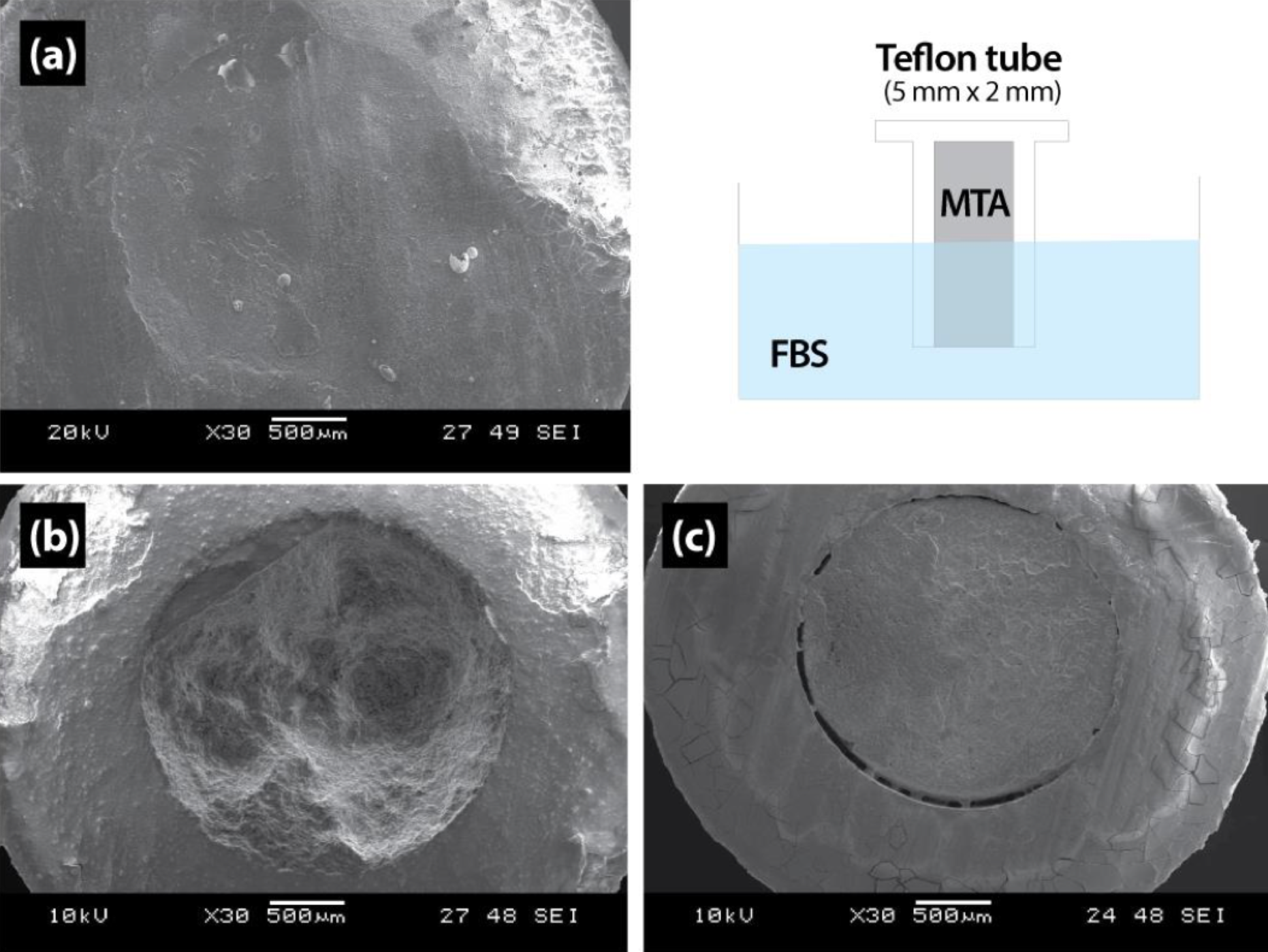 Materials were mixed in accordance with manufacturer’s guidelines and materials were applied in a 5 mm x 2 mm Teflon tube and immersed in FBS (Fetal Bovine Solution). After 24 hours, samples were removed, washed, and observed under SEM. (a) Endocem MTA (b) Proroot MTA (c) IRM