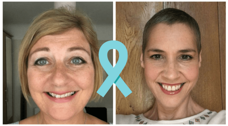 ovarian cancer patient stories