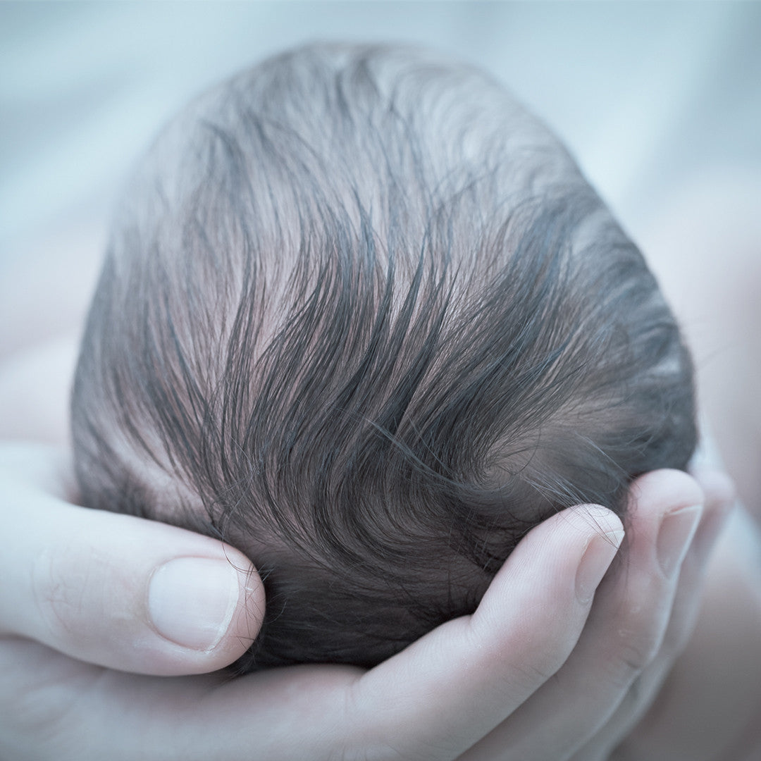 5 Steps to Treat Cradle Cap Naturally
