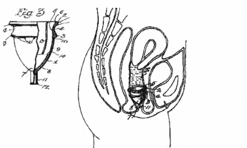 menstrualcup illustrations 1930s