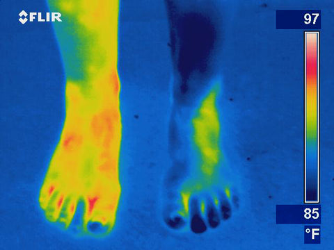 Infrared camera circulation issues in legs