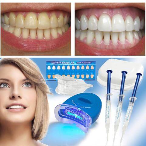 Tooth Whitening with LED Blue Light