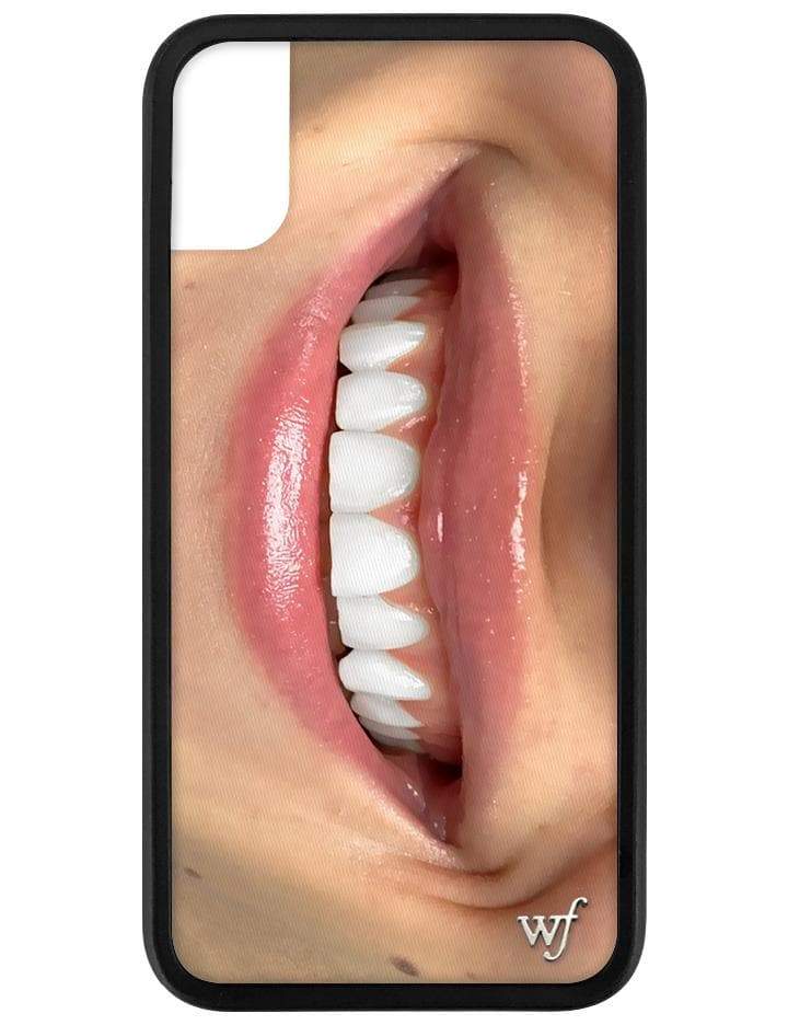 Devon Carlson Smile Iphone X Xs Case Wildflower Cases