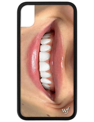 Devon Carlson Smile iPhone Xr Case