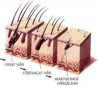 Varför tappar jag håret? Tunnhårig