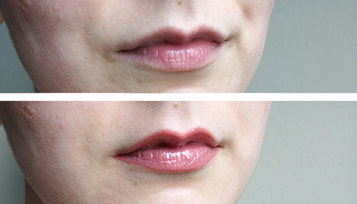 Glamur Lip Plump Before/After