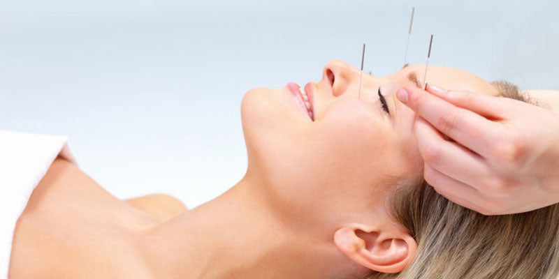 Acupuncture Services Melbourne